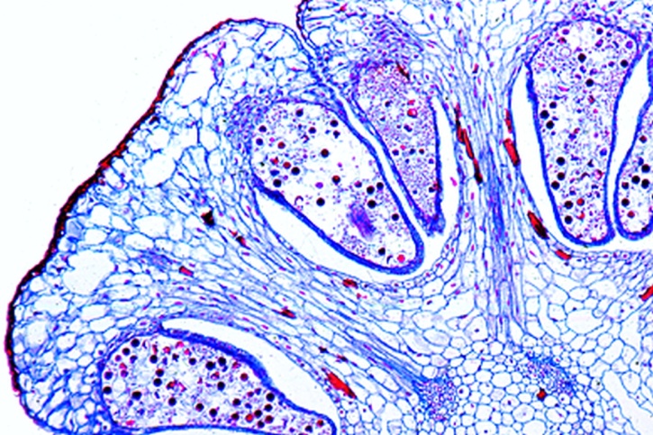 Mikropräparat - Equisetum, Sporophyllstand mit Sporangien, quer