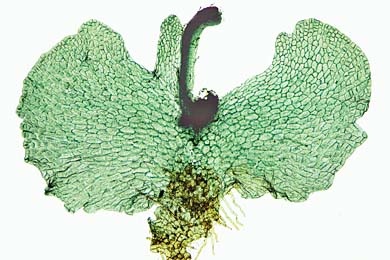 Mikropräparat - Farnprothallium, alteres Stadium mit jungem Sporophyt und Wurzelbildung, total *