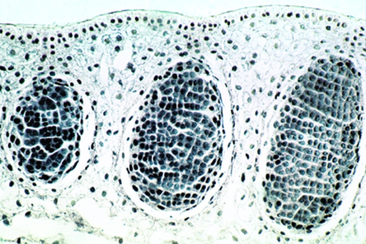 Mikropräparat - Ophioglossum, Sporangienstand, längs