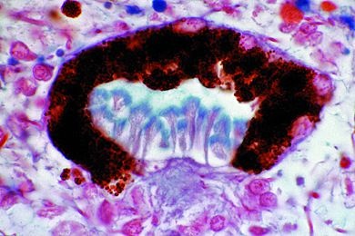 Mikropräparat - Planaria, Schnitt durch Pigmentbecherocellen (Augen)