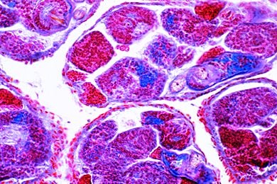 Mikropräparat - Fasciola hepatica, Redien und Cercarien im Schnitt durch eine infizierte Schneckenleber