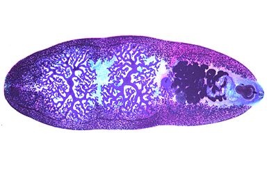 Mikropräparat - Fasciolopsis buski, Großer Eingeweideegel, ganzes Tier...