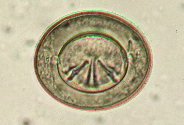 Mikropräparat - Taenia saginata, Eier im Stuhl