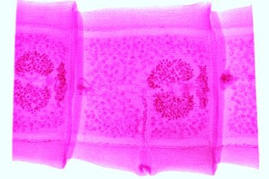 Mikropräparat - Taenia pisiformis, reife Proglottiden, total