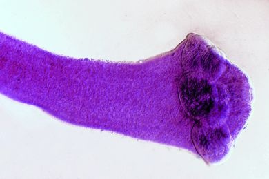 Mikropräparat - Dipylidium caninum, Scolex (Kopf) mit Proglottiden, total