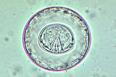 Mikropräparat - Hymenolepis diminuta, Eier, total Mikropräparat - Hymenolepis diminuta, Eier, total