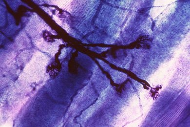 Mikropräparat - Tropidonotus, Motorische Endplatten im Muskel, total