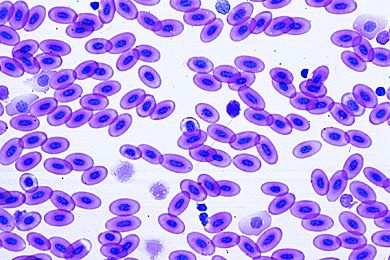 Mikropräparat - Lacerta, Eidechse, Blutausstrich