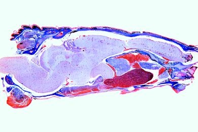 Mikropräparat - Lacerta, Gehirn quer