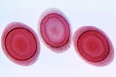 Mikropräparat - Plumatella, Statoblasten, isoliert