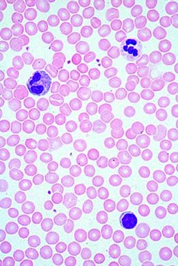 Allgemeinwissen Mikroskopie, Basissatz von 6 Einheiten, Lehrerpaket