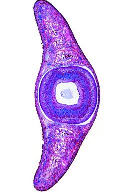 Wirbellose Tiere, Basissatz von 6 Einheiten, Lehrerpaket