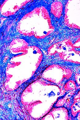 Krankheiten des Menschen (Pathologie), Basissatz von 6 Einheiten