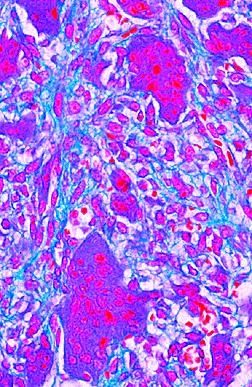 Krankheiten des Menschen (Pathologie), Ergänzungssatz von 12 Ein