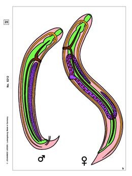 Parasiten, Ergänzungs-CD zu CD-SM-14