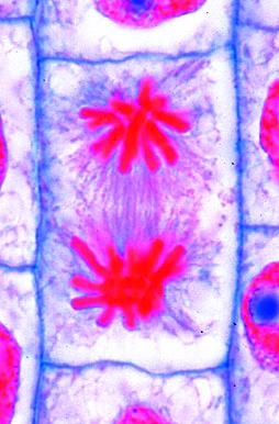 Mikropräparat Multimedia Paket Mitose und Meiose (Zellteilung), Basissatz von 6 Einheiten, Schülersatz