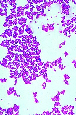 Bakterien, Ergänzungssatz von 12 Einheiten, Lehrerpaket