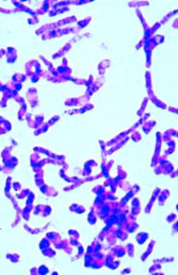 Kennzeichen der Wasserverschmutzung, Basissatz von 6 Einheiten,