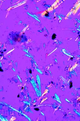 Luftverschmutzung und Allergene, Basissatz von 6 Einheiten, Lehr