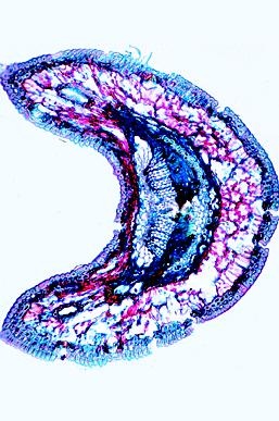 Schädigungen durch Umwelteinflüsse, Basissatz von 8 Einheiten, L