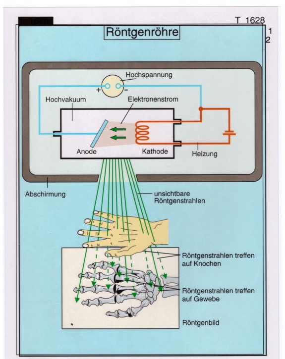 Transparentsatz Röntgenröhre