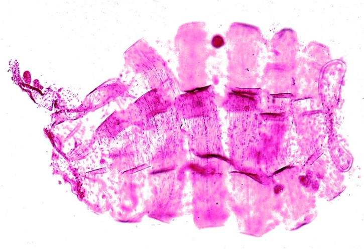 Mikropräparat - Salpe, Amme total *