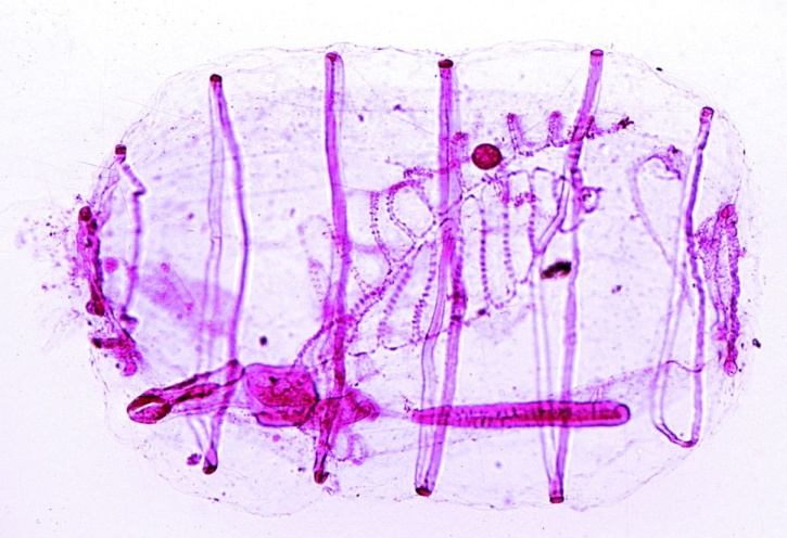 Mikropräparat - Salpe, Geschlechtstier total *