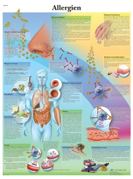 Anatomische Lehrtafel, Allergien