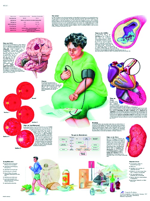 Anatomische Lehrtafel, Bluthochdruck