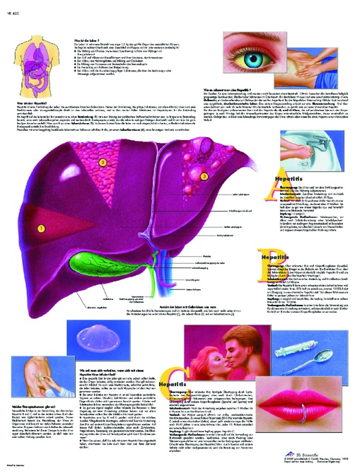 Anatomische Lehrtafel, Hepatitis