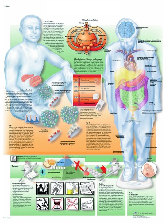Anatomische Lehrtafel, Diabetes mellitus