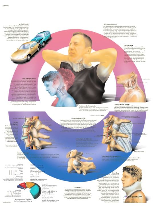 Anatomische Lehrtafel, Beschleunigungs- Verletzungen der Halswirbelsäule
