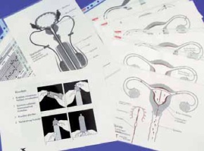 Unterrichtskit Empfängnisverhütung Koffer