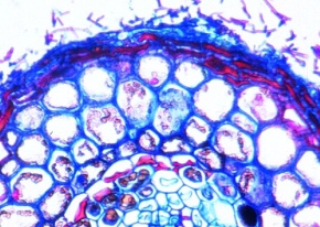 Mikropräparat - Wurzel der Buche mit ektotrophen Mykorrhiza, Querschnitt