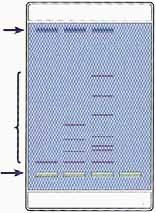 Schlüter-Kit: Elektrophorese-Verfahren, Elektrophorese von Farbstoffen