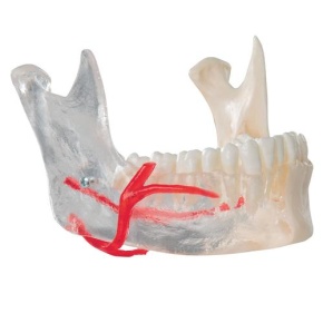 BONElike™ Schädel Modell, transparent und didaktisch aufbereitet, 7-teilig