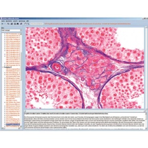 Hormone, Hormonsysteme und Steuerung, Interaktive CD-ROM