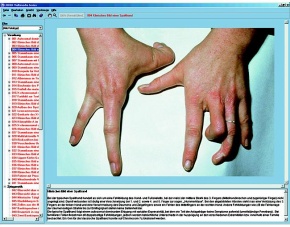 Parasiten und Krankheiten des Menschen, Interaktive CD-ROM