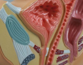 Weiblicher Beckenschnitt, verkleinert