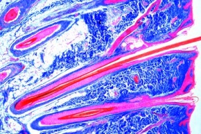 Mikropräparat - Kopfhaut mit Haaren, Haarwurzeln längs