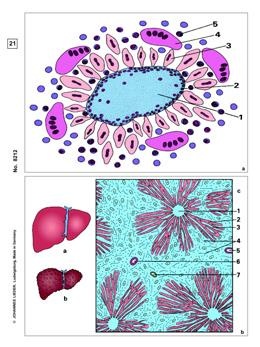 Krankheiten des Menschen (Pathologie), Basissatz von 6 Einheiten