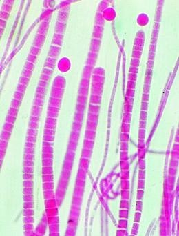 Kennzeichen der Wasserverschmutzung, Basissatz von 6 Einheiten,